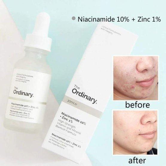 The Ordinary Serum Niacinamide 1